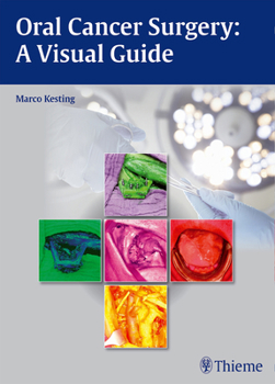 Hardcover Oral Cancer Surgery: A Visual Guide Book