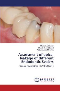 Paperback Assessment of Apical Leakage of Different Endodontic Sealers Book