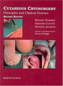 Hardcover Cutaneous Cryosurgery: Principles and Clinical Practice Book