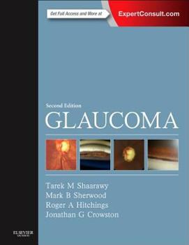 Paperback Glaucoma: 2-Volume Set Book