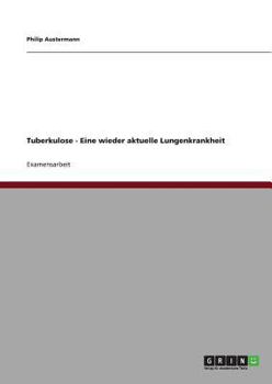 Paperback Tuberkulose - Eine wieder aktuelle Lungenkrankheit [German] Book