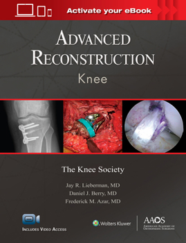 Hardcover Advanced Reconstruction: Knee: Print + eBook with Multimedia Book