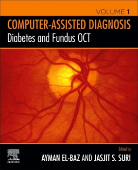 Paperback Diabetes and Fundus Oct Book