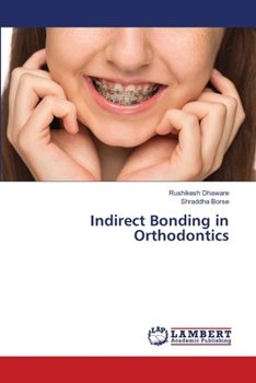 Indirect Bonding in Orthodontics