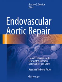 Hardcover Endovascular Aortic Repair: Current Techniques with Fenestrated, Branched and Parallel Stent-Grafts Book