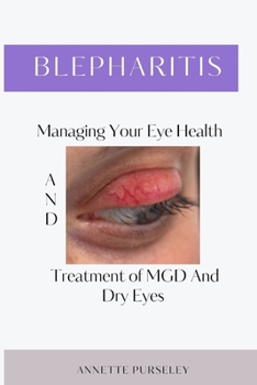 Blepharitis: Managing your Eye Health and Treatment of MGD, Dry Eyes