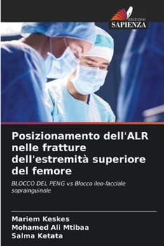 Posizionamento dell'ALR nelle fratture dell'estremità superiore del femore (Italian Edition)