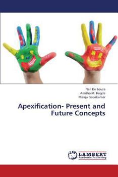 Paperback Apexification- Present and Future Concepts Book