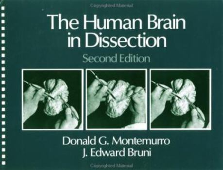 Plastic Comb The Human Brain in Dissection Book