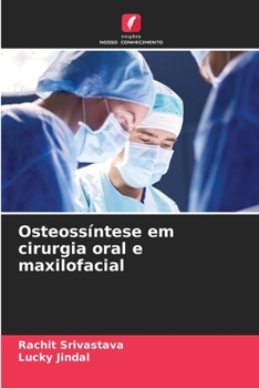 Osteossíntese em cirurgia oral e maxilofacial (Portuguese Edition)