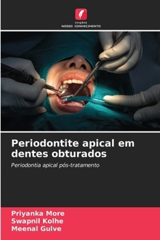 Paperback Periodontite apical em dentes obturados [Portuguese] Book
