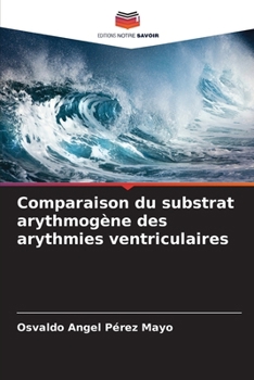 Paperback Comparaison du substrat arythmogène des arythmies ventriculaires [French] Book