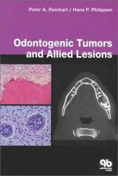 Hardcover Odontogenic Tumors and Allied Lesions Book