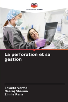 Paperback La perforation et sa gestion [French] Book