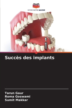 Paperback Succès des implants [French] Book