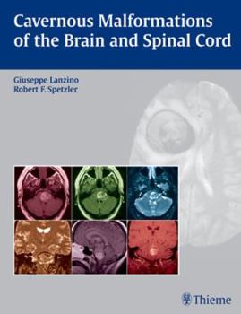 Hardcover Cavernous Malformations of the Brain and Spinal Cord Book