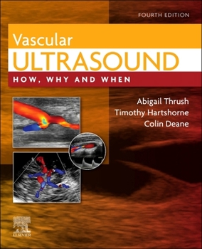 Hardcover Vascular Ultrasound: How, Why and When Book