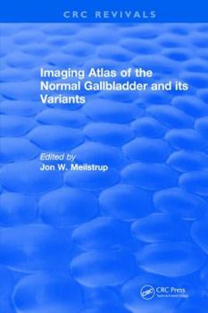 Hardcover Imaging Atlas of the Normal Gallbladder and Its Variants Book
