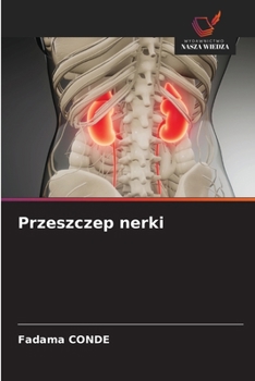Paperback Przeszczep nerki [Polish] Book