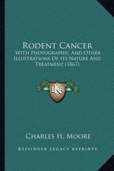 Paperback Rodent Cancer: With Photographic And Other Illustrations Of Its Nature And Treatment (1867) Book