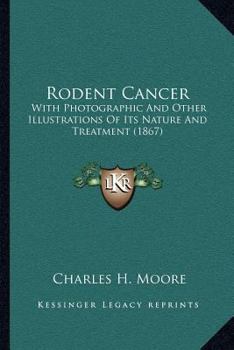 Rodent Cancer: With Photographic And Other Illustrations Of Its Nature And Treatment