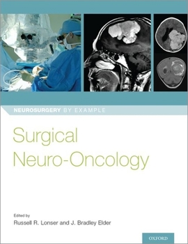 Paperback Surgical Neuro-Oncology Book