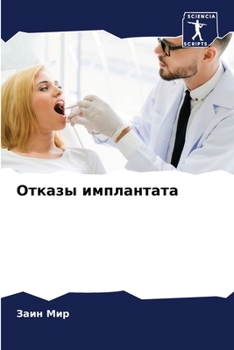 Paperback Отказы имплантата [Russian] Book
