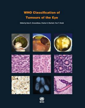 Paperback Who Classification of Tumours of the Eye Book