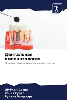 Paperback Дентальная имплантолог&# [Russian] Book