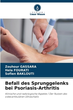 Paperback Befall des Sprunggelenks bei Psoriasis-Arthritis [German] Book