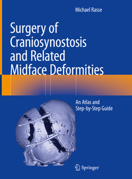 Hardcover Surgery of Craniosynostosis and Related Midface Deformities: An Atlas and Step-By-Step Guide Book
