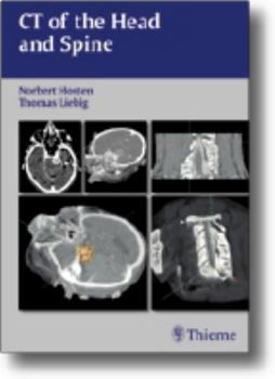 Plastic Comb CT of the Head and Spine Book