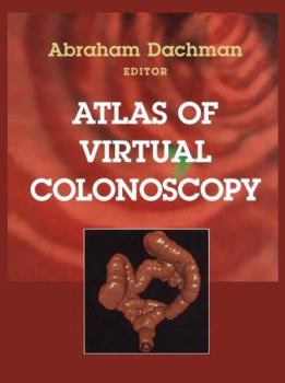 Hardcover Atlas of Virtual Colonoscopy Book