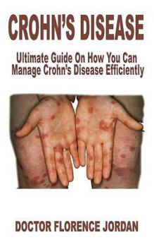 CROHN’S DISEASE: Ultimate Guide On How You Can Manage Crohn’s Disease Efficiently