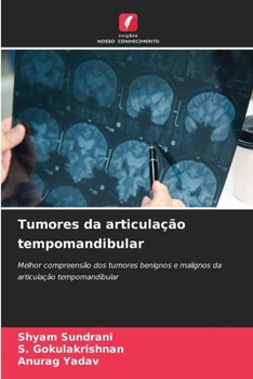 Paperback Tumores da articulação tempomandibular [Portuguese] Book
