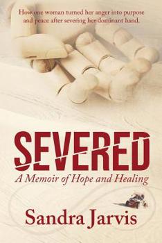Paperback Severed: A Memoir of Hope and Healing Book