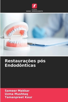 Paperback Restaurações pós Endodônticas [Portuguese] Book