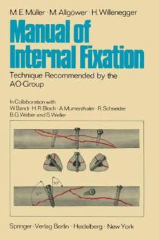 Paperback Manual of Internal Fixation: Technique Recommended by the Ao-Group Swiss Association for the Study of Internal Fixation: Asif Book