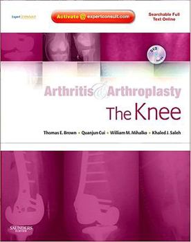 Hardcover Arthritis and Arthroplasty: The Knee: Expert Consult - Online, Print and DVD Book