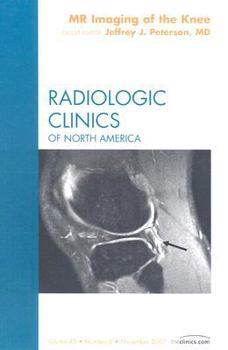 Hardcover MR Imaging of the Knee, An Issue of Radiologic Clinics of North America (Volume 45-6) (The Clinics: Radiology, Volume 45-6) Book
