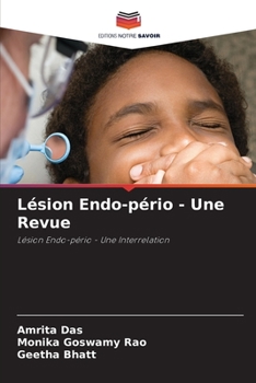 Paperback Lésion Endo-pério - Une Revue [French] Book