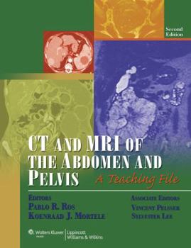 Hardcover CT and MRI of the Abdomen and Pelvis: A Teaching File (LWW Teaching File Series), 2e Book
