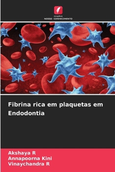 Paperback Fibrina rica em plaquetas em Endodontia [Portuguese] Book
