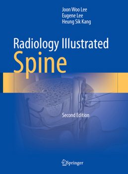 Hardcover Radiology Illustrated: Spine Book