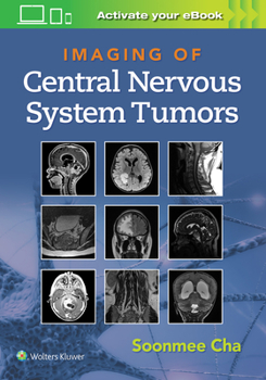 Hardcover Imaging of Central Nervous System Tumors Book