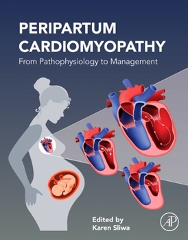 Paperback Peripartum Cardiomyopathy: From Pathophysiology to Management Book