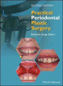 Hardcover Practical Periodontal Plastic Surgery Book