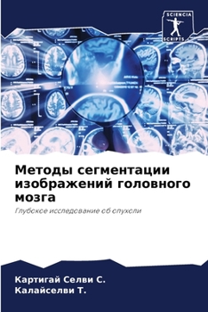 Paperback Методы сегментации изоб& [Russian] Book