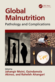 Paperback Global Malnutrition: Pathology and Complications Book