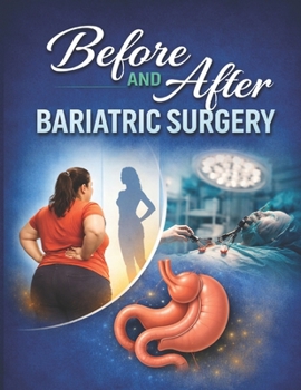 Paperback BEFORE AND AFTER BARIATRIC SURGERY Book